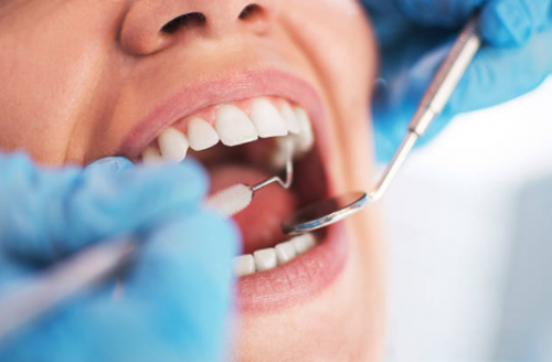 a close up view of a woman getting a dental check up